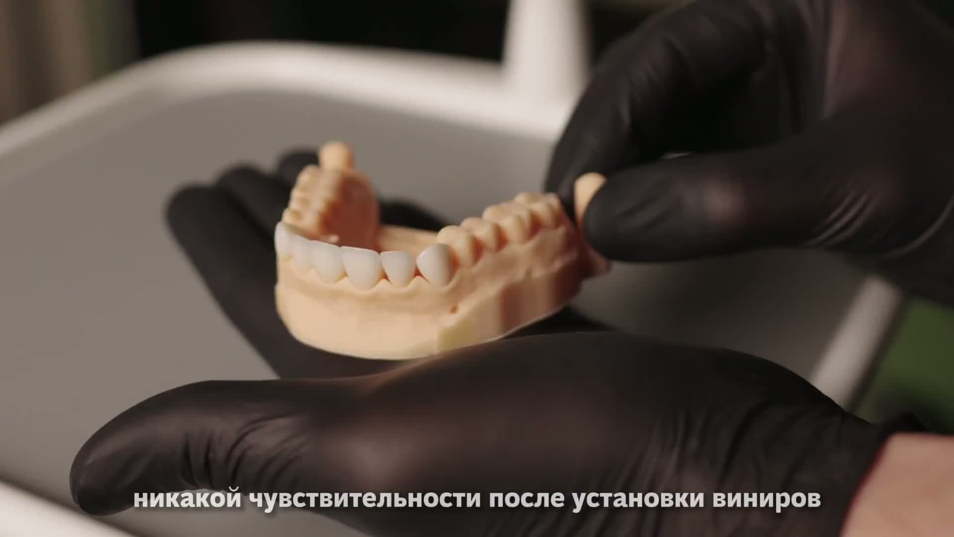 Видео об ультратонких винирах